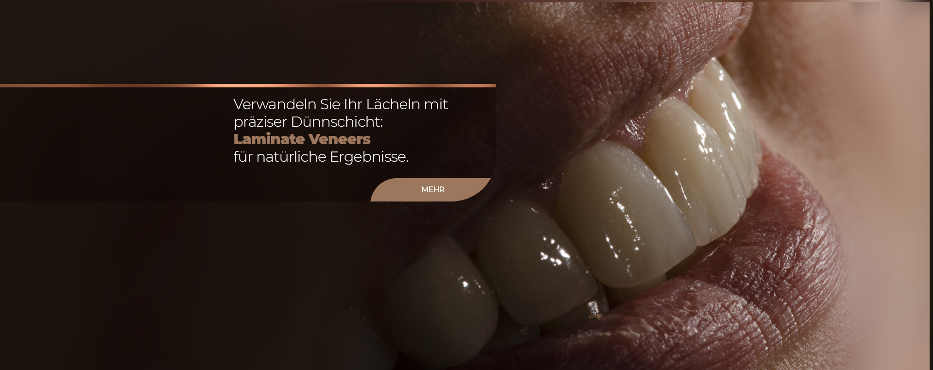 lorem ipsum dolor sit