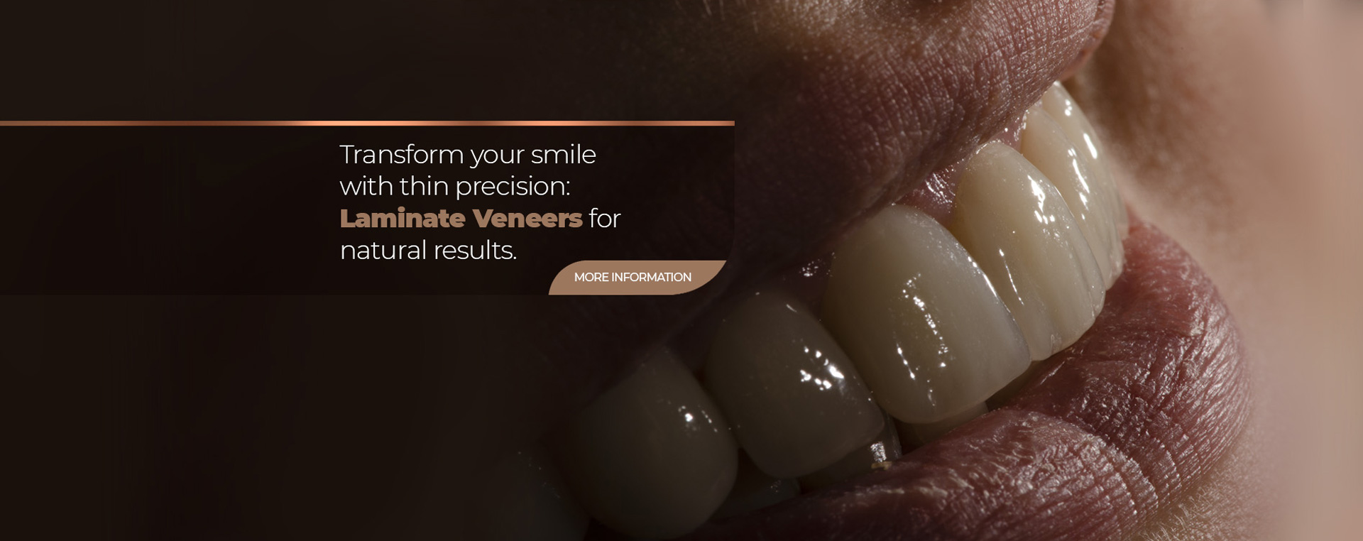 lorem ipsum dolor sit